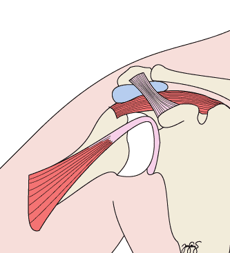 di-shoulder-impingement