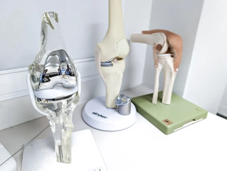 Hip and knee joint models used to explain surgery in the consulting room